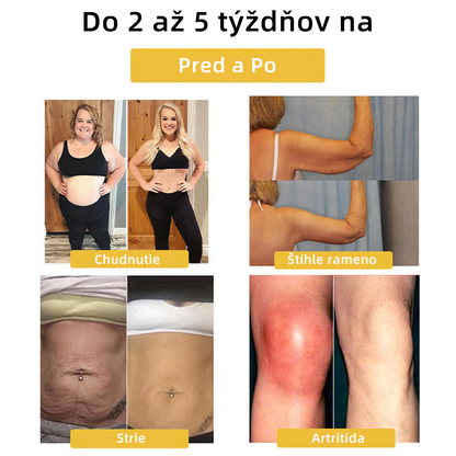 𝐶𝑍𝑇𝐼𝐶𝐿𝐸™ Magnetický terapeutický lymfatický prsteň s očkom mačky💍-20% zľava na obmedzený čas❤️‍🔥