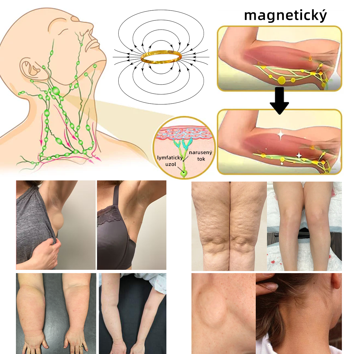 𝐶𝑍𝑇𝐼𝐶𝐿𝐸™ Magnetický terapeutický lymfatický prsteň s očkom mačky💍-20% zľava na obmedzený čas❤️‍🔥