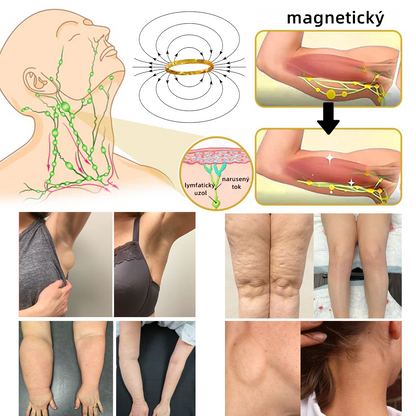 𝐶𝑍𝑇𝐼𝐶𝐿𝐸™ Magnetický terapeutický lymfatický prsteň s očkom mačky💍-20% zľava na obmedzený čas❤️‍🔥