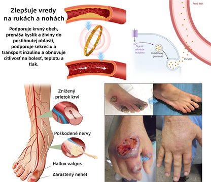 𝐶𝑍𝑇𝐼𝐶𝐿𝐸™ Magnetický terapeutický lymfatický prsteň s očkom mačky💍-20% zľava na obmedzený čas❤️‍🔥