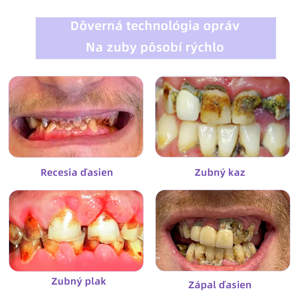 𝑂𝑦𝑖𝑘𝑒𝑦™🦷 𝑜𝑏𝑛𝑜𝑣𝑢 𝑧𝑢𝑏𝑜𝑣 𝑀𝑖𝑛𝑒𝑟á𝑙𝑛𝑦 𝑝𝑟áš𝑜𝑘  (𝑜𝑑𝑝𝑜𝑟úč𝑎𝑛é 𝑆𝐾𝑍𝐿) 👨‍⚕️