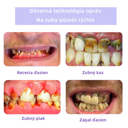 𝑂𝑦𝑖𝑘𝑒𝑦™🦷 𝑜𝑏𝑛𝑜𝑣𝑢 𝑧𝑢𝑏𝑜𝑣 𝑀𝑖𝑛𝑒𝑟á𝑙𝑛𝑦 𝑝𝑟áš𝑜𝑘  (𝑜𝑑𝑝𝑜𝑟úč𝑎𝑛é 𝑆𝐾𝑍𝐿) 👨‍⚕️