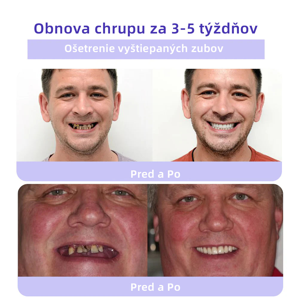 𝑂𝑦𝑖𝑘𝑒𝑦™🦷 𝑜𝑏𝑛𝑜𝑣𝑢 𝑧𝑢𝑏𝑜𝑣 𝑀𝑖𝑛𝑒𝑟á𝑙𝑛𝑦 𝑝𝑟áš𝑜𝑘  (𝑜𝑑𝑝𝑜𝑟úč𝑎𝑛é 𝑆𝐾𝑍𝐿) 👨‍⚕️