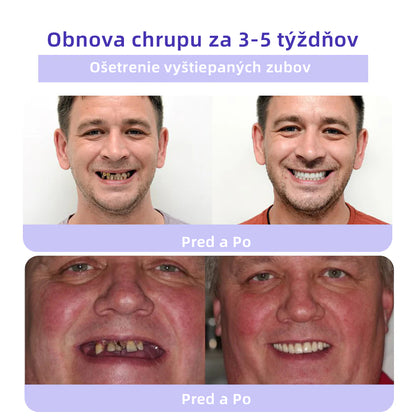 𝑂𝑦𝑖𝑘𝑒𝑦™🦷 𝑜𝑏𝑛𝑜𝑣𝑢 𝑧𝑢𝑏𝑜𝑣 𝑀𝑖𝑛𝑒𝑟á𝑙𝑛𝑦 𝑝𝑟áš𝑜𝑘  (𝑜𝑑𝑝𝑜𝑟úč𝑎𝑛é 𝑆𝐾𝑍𝐿) 👨‍⚕️