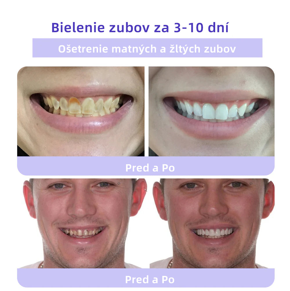 𝑂𝑦𝑖𝑘𝑒𝑦™🦷 𝑜𝑏𝑛𝑜𝑣𝑢 𝑧𝑢𝑏𝑜𝑣 𝑀𝑖𝑛𝑒𝑟á𝑙𝑛𝑦 𝑝𝑟áš𝑜𝑘  (𝑜𝑑𝑝𝑜𝑟úč𝑎𝑛é 𝑆𝐾𝑍𝐿) 👨‍⚕️