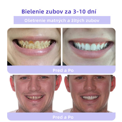 𝑂𝑦𝑖𝑘𝑒𝑦™🦷 𝑜𝑏𝑛𝑜𝑣𝑢 𝑧𝑢𝑏𝑜𝑣 𝑀𝑖𝑛𝑒𝑟á𝑙𝑛𝑦 𝑝𝑟áš𝑜𝑘  (𝑜𝑑𝑝𝑜𝑟úč𝑎𝑛é 𝑆𝐾𝑍𝐿) 👨‍⚕️
