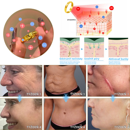 𝐶𝑍𝑇𝐼𝐶𝐿𝐸™ Magnetický terapeutický lymfatický prsteň s očkom mačky💍-20% zľava na obmedzený čas❤️‍🔥