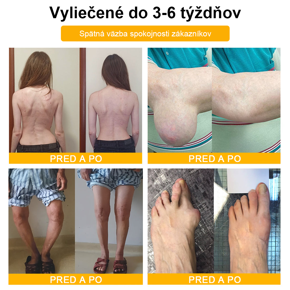 FATONG™ Krém na bolesti kĺbov s včelím jedom na hojenie kostí(🐝špeciálne pre starších dospelých a odporúča AAOS) 🐝