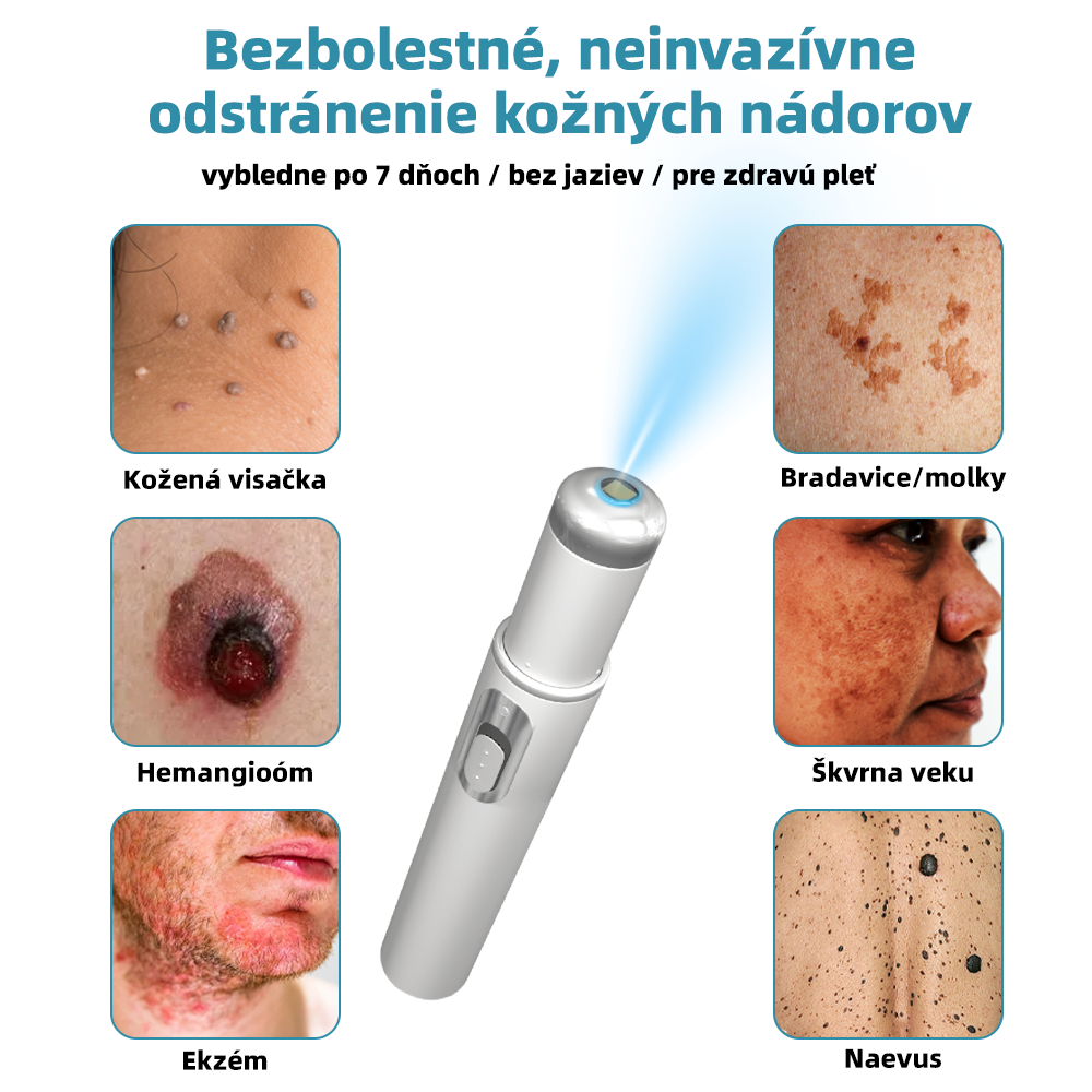 𝐤𝑖𝒅𝘴𝘯𝘦𝘦𝘥® Neinvazívne laserové pero – dôrazne odporúčané Slovenskou dermatovenerologickou spoločnosťou (SDVS) 🔥