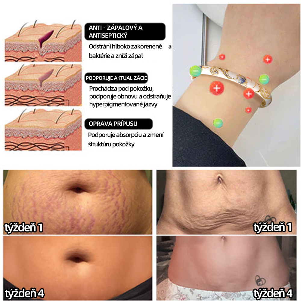 𝐂𝐙𝐓𝐈𝐂𝐋𝐄™Zlatý náramok s kláštornou emalou👩‍⚕️ Magnetická lymfatická terapia❤️‍🔥