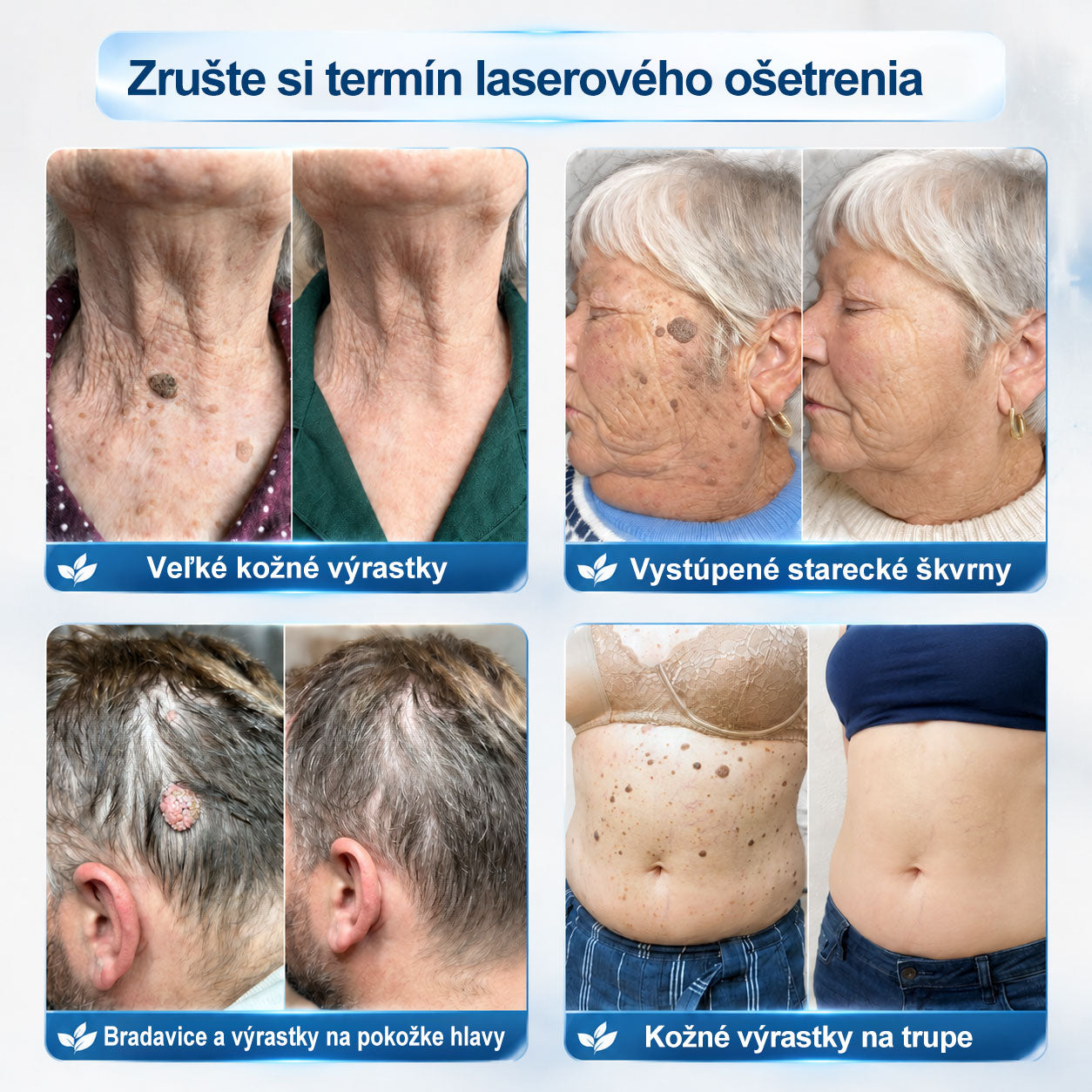 𝐏i𝐜𝐝o® 7-𝐷𝑎𝑦 𝗧𝐚𝐠 & 𝗦𝗽𝐨𝐭 𝐄𝐫𝒂𝒔𝒆𝒓(Zero Pain, Zero 𝐒𝐜𝐚𝒓𝒔 Rollerball)💪