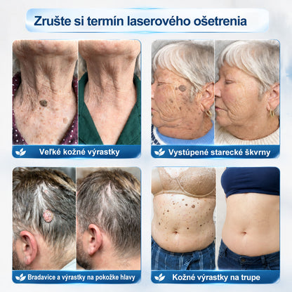 𝐏i𝐜𝐝o® 7-𝐷𝑎𝑦 𝗧𝐚𝐠 & 𝗦𝗽𝐨𝐭 𝐄𝐫𝒂𝒔𝒆𝒓(Zero Pain, Zero 𝐒𝐜𝐚𝒓𝒔 Rollerball)💪