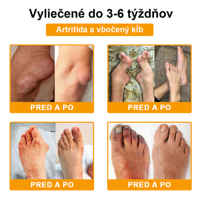 FATONG™ Krém na bolesti kĺbov s včelím jedom na hojenie kostí(🐝špeciálne pre starších dospelých a odporúča AAOS) 🐝