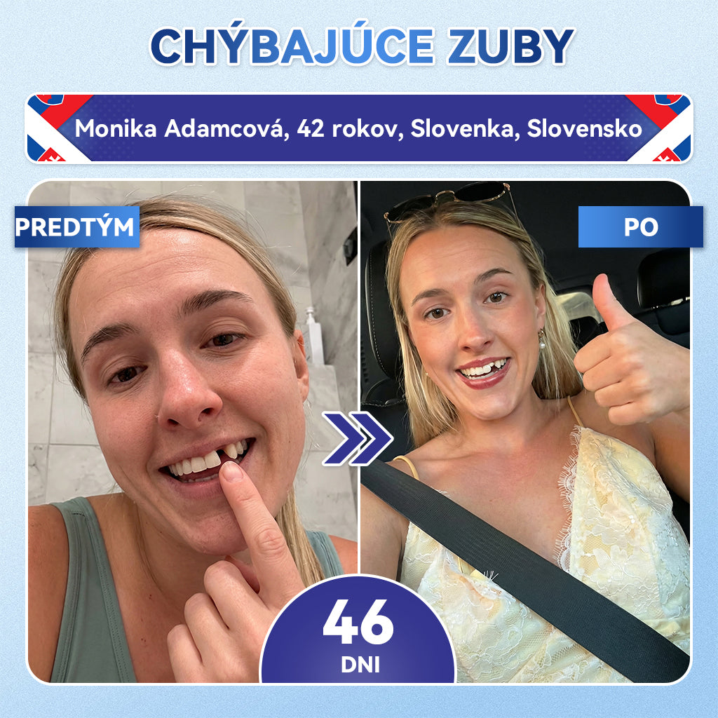 𝑮𝒍𝒊𝒎𝒎𝒆𝒓𝒍𝒚®🦷 𝑻𝒊𝒅𝒆𝒈𝒍𝒖𝒔𝒊𝒃 𝒎𝒊𝒌𝒓𝒐𝒊𝒉𝒍𝒊č𝒌𝒐𝒗é 𝒏á𝒑𝒍𝒂𝒔𝒕𝒊 𝒏𝒂 𝒐𝒃𝒏𝒐𝒗𝒖 𝒛𝒖𝒃𝒐𝒗 𝒂 ď𝒂𝒔𝒊𝒆𝒏 👩‍⚕️(𝑂𝑏𝑛𝑜𝑣𝑎 𝑧𝑢𝑏𝑛𝑒𝑗 𝑠𝑘𝑙𝑜𝑣𝑖𝑛𝑦 𝑎 𝑑𝑒𝑛𝑡í𝑛𝑢 • 𝑆𝑝𝑒𝑣𝑛𝑒𝑛𝑖𝑒 ď𝑎𝑠𝑖𝑒𝑛 • 𝑂𝑑𝑠𝑡𝑟𝑎ň𝑜𝑣𝑎𝑛𝑖𝑒 𝑧𝑢𝑏𝑛éℎ𝑜 𝑝𝑜𝑣𝑙𝑎𝑘𝑢 𝑎 𝑧á𝑝𝑎𝑐ℎ𝑢 • 𝑍𝑚𝑖𝑒𝑟𝑛𝑒𝑛𝑖𝑒 𝑐𝑖𝑡𝑙𝑖𝑣𝑜𝑠𝑡𝑖 𝑧𝑢𝑏𝑜𝑣)❤️‍🔥