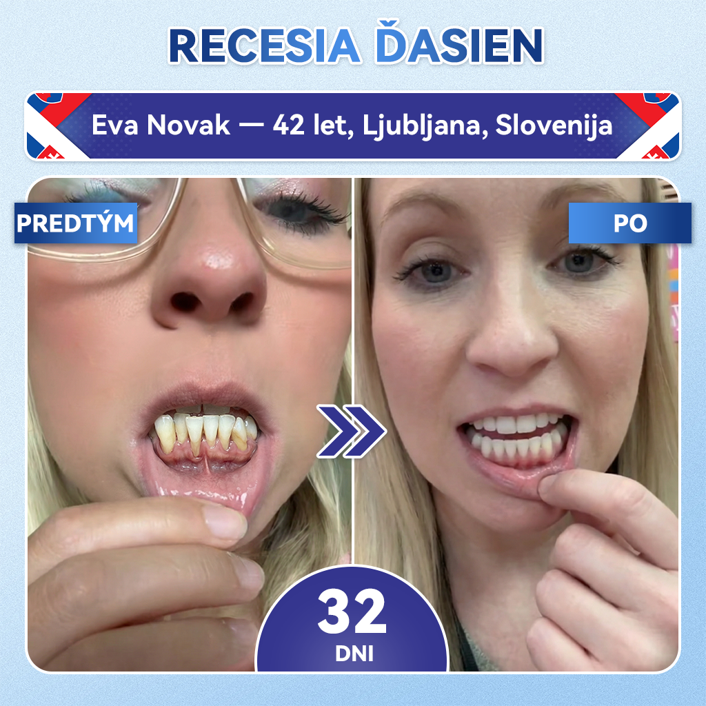 𝑮𝒍𝒊𝒎𝒎𝒆𝒓𝒍𝒚®🦷 𝑻𝒊𝒅𝒆𝒈𝒍𝒖𝒔𝒊𝒃 𝒎𝒊𝒌𝒓𝒐𝒊𝒉𝒍𝒊č𝒌𝒐𝒗é 𝒏á𝒑𝒍𝒂𝒔𝒕𝒊 𝒏𝒂 𝒐𝒃𝒏𝒐𝒗𝒖 𝒛𝒖𝒃𝒐𝒗 𝒂 ď𝒂𝒔𝒊𝒆𝒏 👩‍⚕️(𝑂𝑏𝑛𝑜𝑣𝑎 𝑧𝑢𝑏𝑛𝑒𝑗 𝑠𝑘𝑙𝑜𝑣𝑖𝑛𝑦 𝑎 𝑑𝑒𝑛𝑡í𝑛𝑢 • 𝑆𝑝𝑒𝑣𝑛𝑒𝑛𝑖𝑒 ď𝑎𝑠𝑖𝑒𝑛 • 𝑂𝑑𝑠𝑡𝑟𝑎ň𝑜𝑣𝑎𝑛𝑖𝑒 𝑧𝑢𝑏𝑛éℎ𝑜 𝑝𝑜𝑣𝑙𝑎𝑘𝑢 𝑎 𝑧á𝑝𝑎𝑐ℎ𝑢 • 𝑍𝑚𝑖𝑒𝑟𝑛𝑒𝑛𝑖𝑒 𝑐𝑖𝑡𝑙𝑖𝑣𝑜𝑠𝑡𝑖 𝑧𝑢𝑏𝑜𝑣)❤️‍🔥