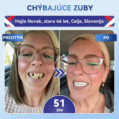 𝑮𝒍𝒊𝒎𝒎𝒆𝒓𝒍𝒚®🦷 𝑻𝒊𝒅𝒆𝒈𝒍𝒖𝒔𝒊𝒃 𝒎𝒊𝒌𝒓𝒐𝒊𝒉𝒍𝒊č𝒌𝒐𝒗é 𝒏á𝒑𝒍𝒂𝒔𝒕𝒊 𝒏𝒂 𝒐𝒃𝒏𝒐𝒗𝒖 𝒛𝒖𝒃𝒐𝒗 𝒂 ď𝒂𝒔𝒊𝒆𝒏 👩‍⚕️(𝑂𝑏𝑛𝑜𝑣𝑎 𝑧𝑢𝑏𝑛𝑒𝑗 𝑠𝑘𝑙𝑜𝑣𝑖𝑛𝑦 𝑎 𝑑𝑒𝑛𝑡í𝑛𝑢 • 𝑆𝑝𝑒𝑣𝑛𝑒𝑛𝑖𝑒 ď𝑎𝑠𝑖𝑒𝑛 • 𝑂𝑑𝑠𝑡𝑟𝑎ň𝑜𝑣𝑎𝑛𝑖𝑒 𝑧𝑢𝑏𝑛éℎ𝑜 𝑝𝑜𝑣𝑙𝑎𝑘𝑢 𝑎 𝑧á𝑝𝑎𝑐ℎ𝑢 • 𝑍𝑚𝑖𝑒𝑟𝑛𝑒𝑛𝑖𝑒 𝑐𝑖𝑡𝑙𝑖𝑣𝑜𝑠𝑡𝑖 𝑧𝑢𝑏𝑜𝑣)❤️‍🔥