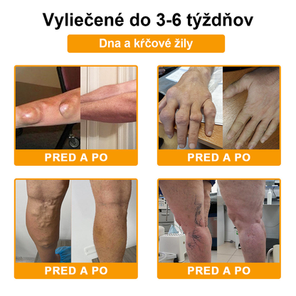 FATONG™ Krém na bolesti kĺbov s včelím jedom na hojenie kostí(🐝špeciálne pre starších dospelých a odporúča AAOS) 🐝