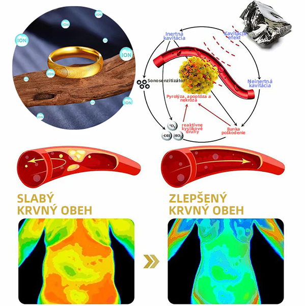 （🔥Posledný deň výpredaja - 80% zľava）𝐶𝑍𝑇𝐼𝐶𝐿𝐸™ 💖Lymfatický magnetický terapeutický prsteň s mačacím okom