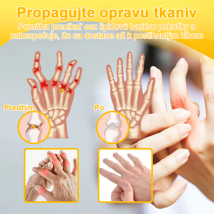 FATONG™ Krém na bolesti kĺbov s včelím jedom na hojenie kostí(🐝špeciálne pre starších dospelých a odporúča AAOS) 🐝