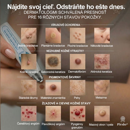 𝐏i𝐜𝐝o® 7-𝐷𝑎𝑦 𝗧𝐚𝐠 & 𝗦𝗽𝐨𝐭 𝐄𝐫𝒂𝒔𝒆𝒓(Zero Pain, Zero 𝐒𝐜𝐚𝒓𝒔 Rollerball)💪