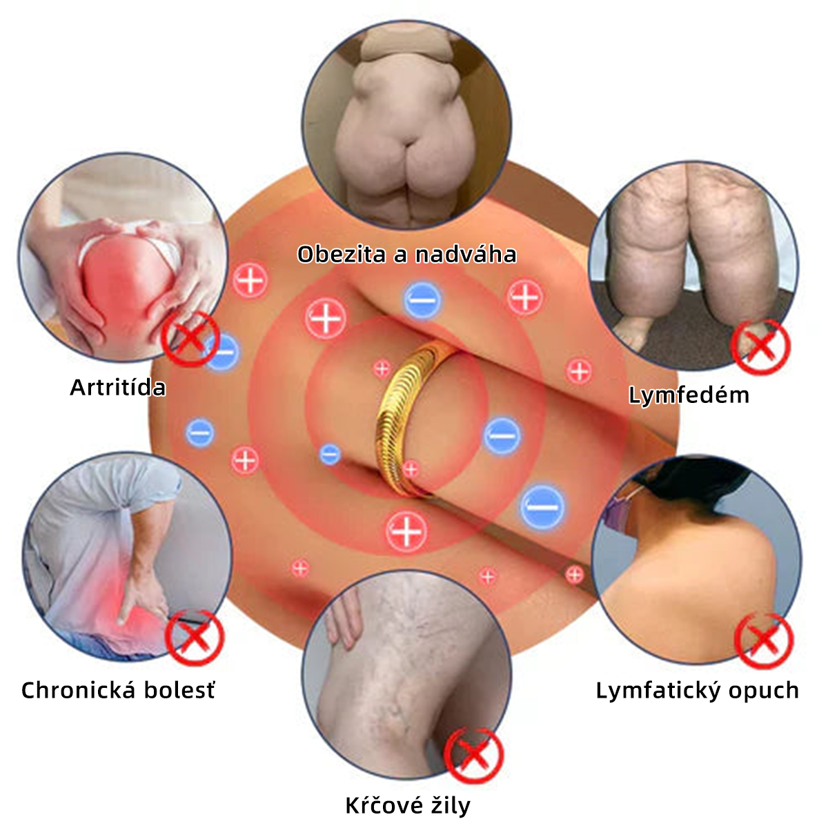 𝐶𝑍𝑇𝐼𝐶𝐿𝐸™ Magnetický terapeutický lymfatický prsteň s očkom mačky💍-20% zľava na obmedzený čas❤️‍🔥
