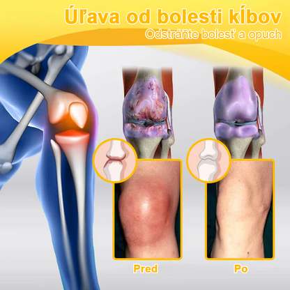 FATONG™ Krém na bolesti kĺbov s včelím jedom na hojenie kostí(🐝špeciálne pre starších dospelých a odporúča AAOS) 🐝