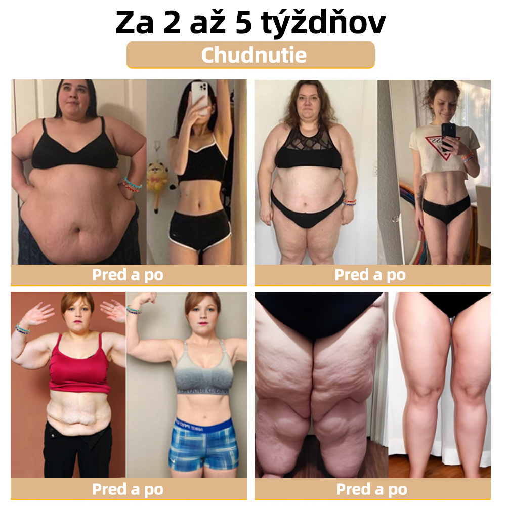 𝐂𝐙𝐓𝐈𝐂𝐋𝐄™Zlatý náramok s kláštornou emalou👩‍⚕️ Magnetická lymfatická terapia❤️‍🔥