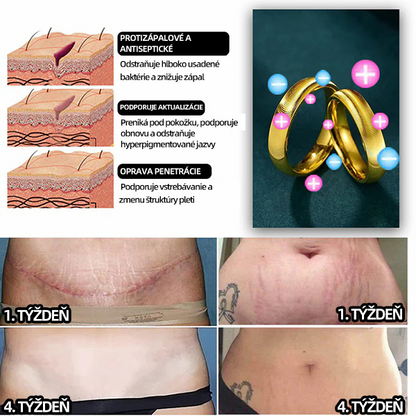 （🔥Posledný deň výpredaja - 80% zľava）𝐶𝑍𝑇𝐼𝐶𝐿𝐸™ 💖Lymfatický magnetický terapeutický prsteň s mačacím okom