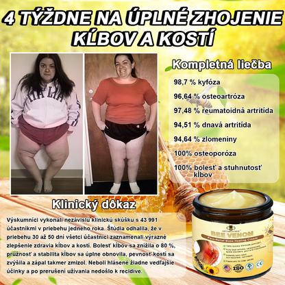 FATONG™ Krém na bolesti kĺbov s včelím jedom na hojenie kostí(🐝špeciálne pre starších dospelých a odporúča AAOS) 🐝